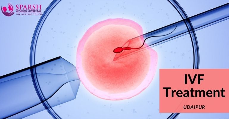 IVF Treatmnt in Udaipur Sparsh Hospital