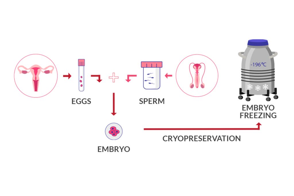 Secure Your Future Parenthood | Best Fertility Preservation & Freezing ...