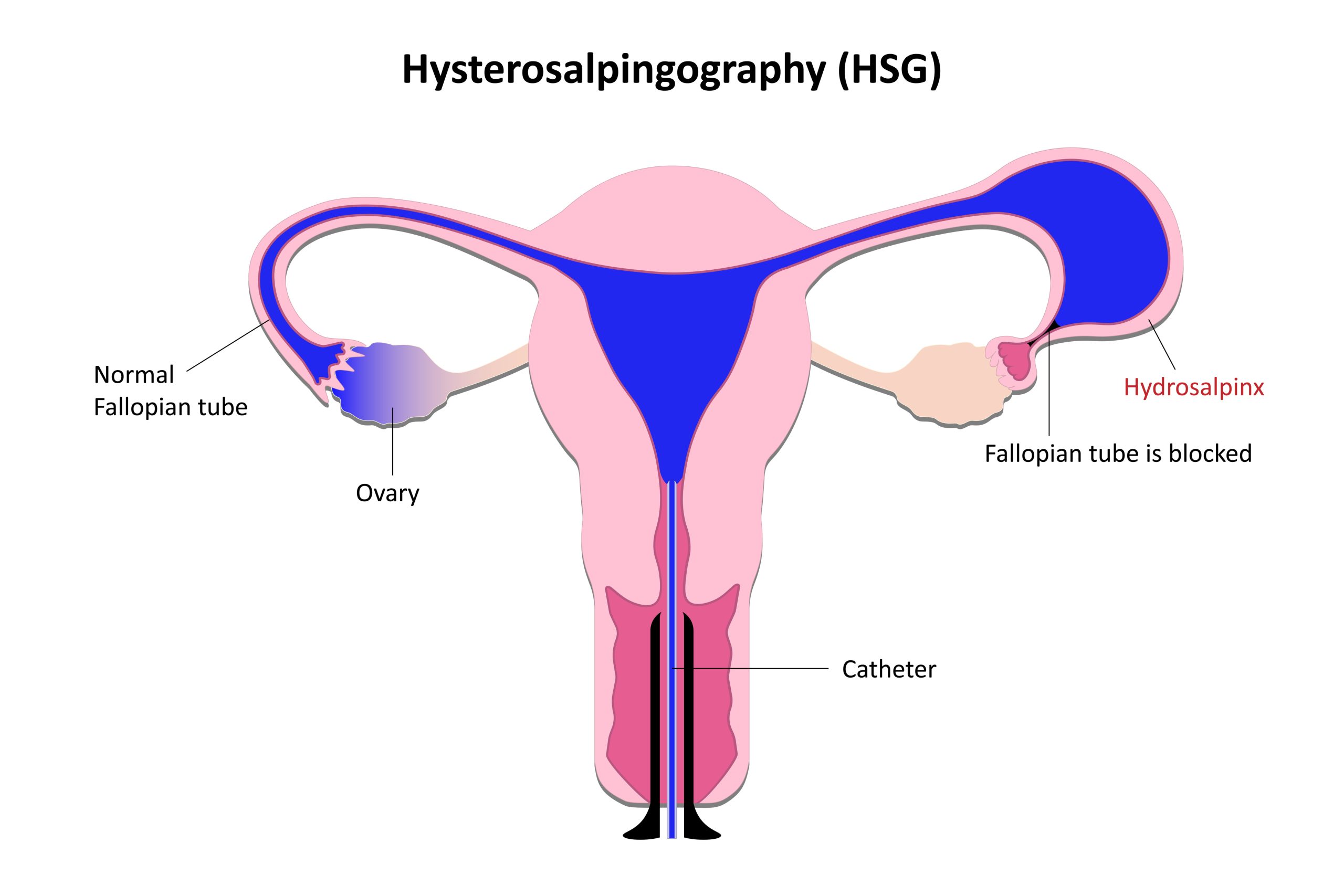 best gynecologist in udaipur