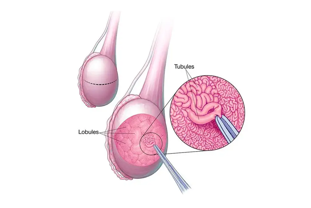IVF Treatment In Udaipur india