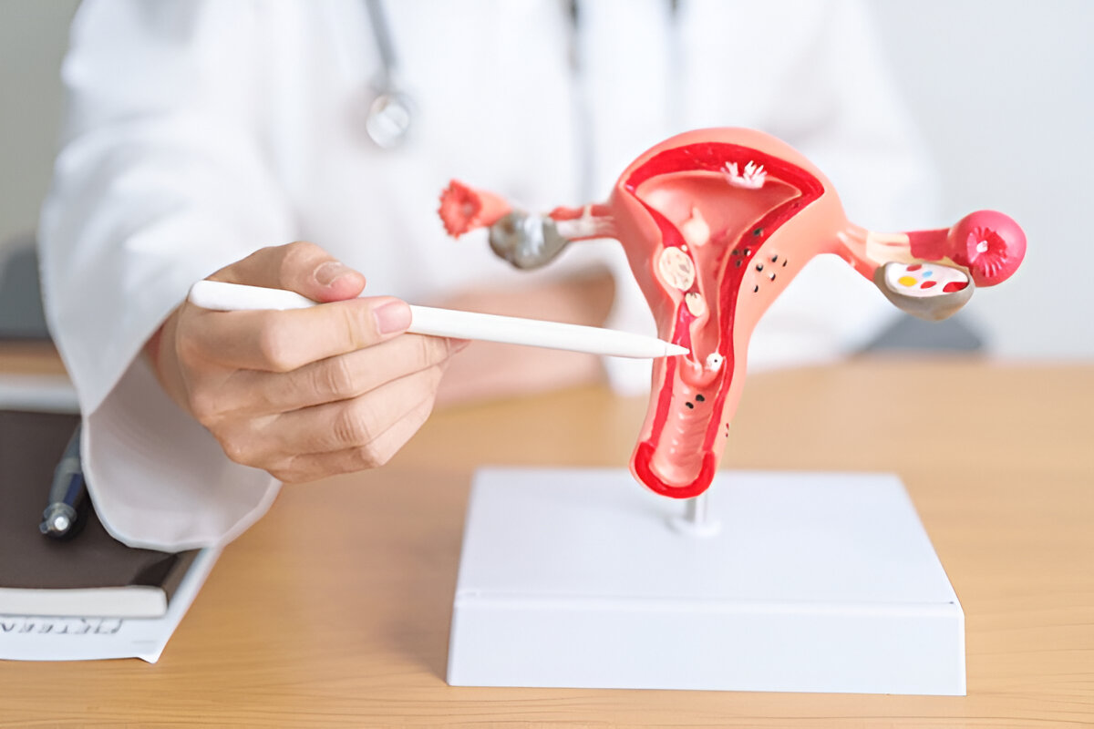 Female Infertility Causes
