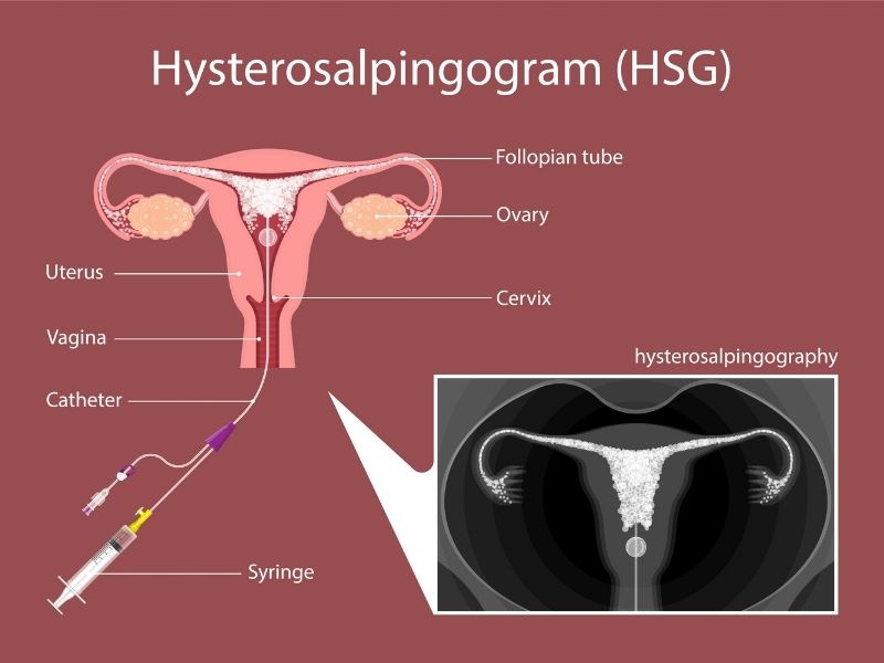 ivf specialist in udaipur india