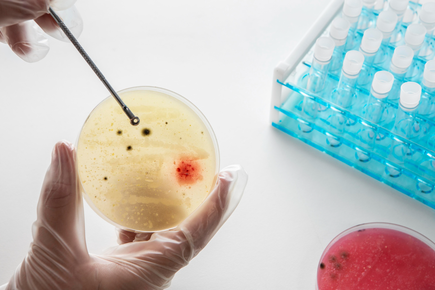 IVF Specialist in udaipur India