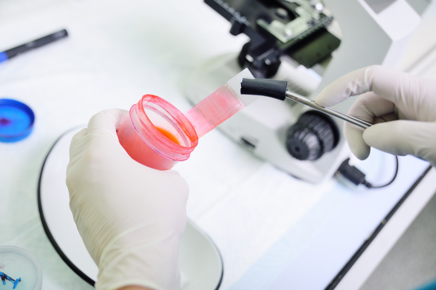 best IVF Treatment In Udaipur India