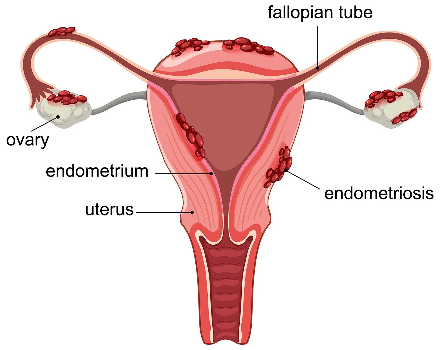 female infertility specialist in udaipur india
