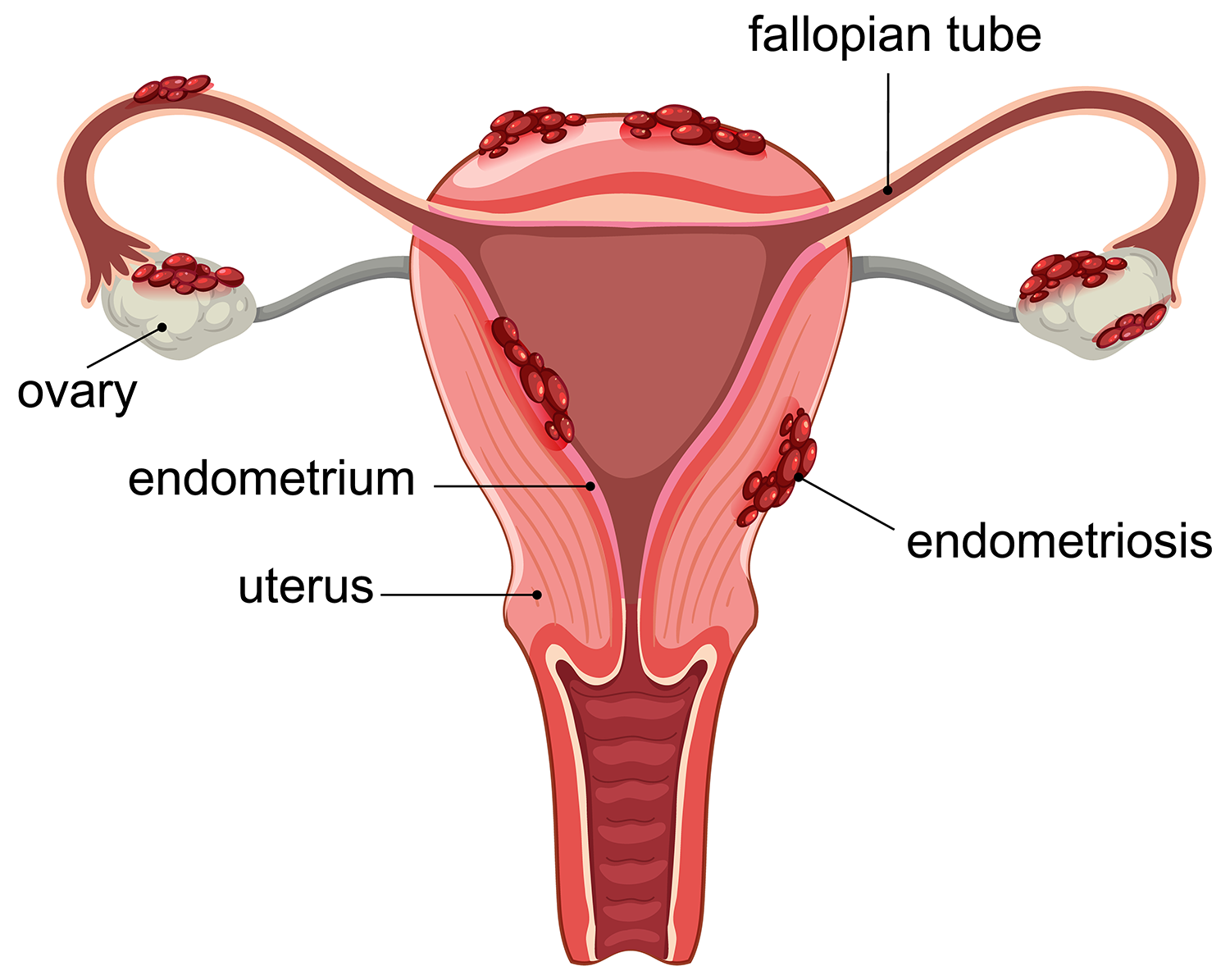 female infertility specialist in udaipur india