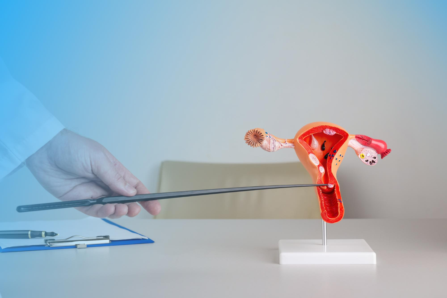 Laparoscopy treatment Surgery