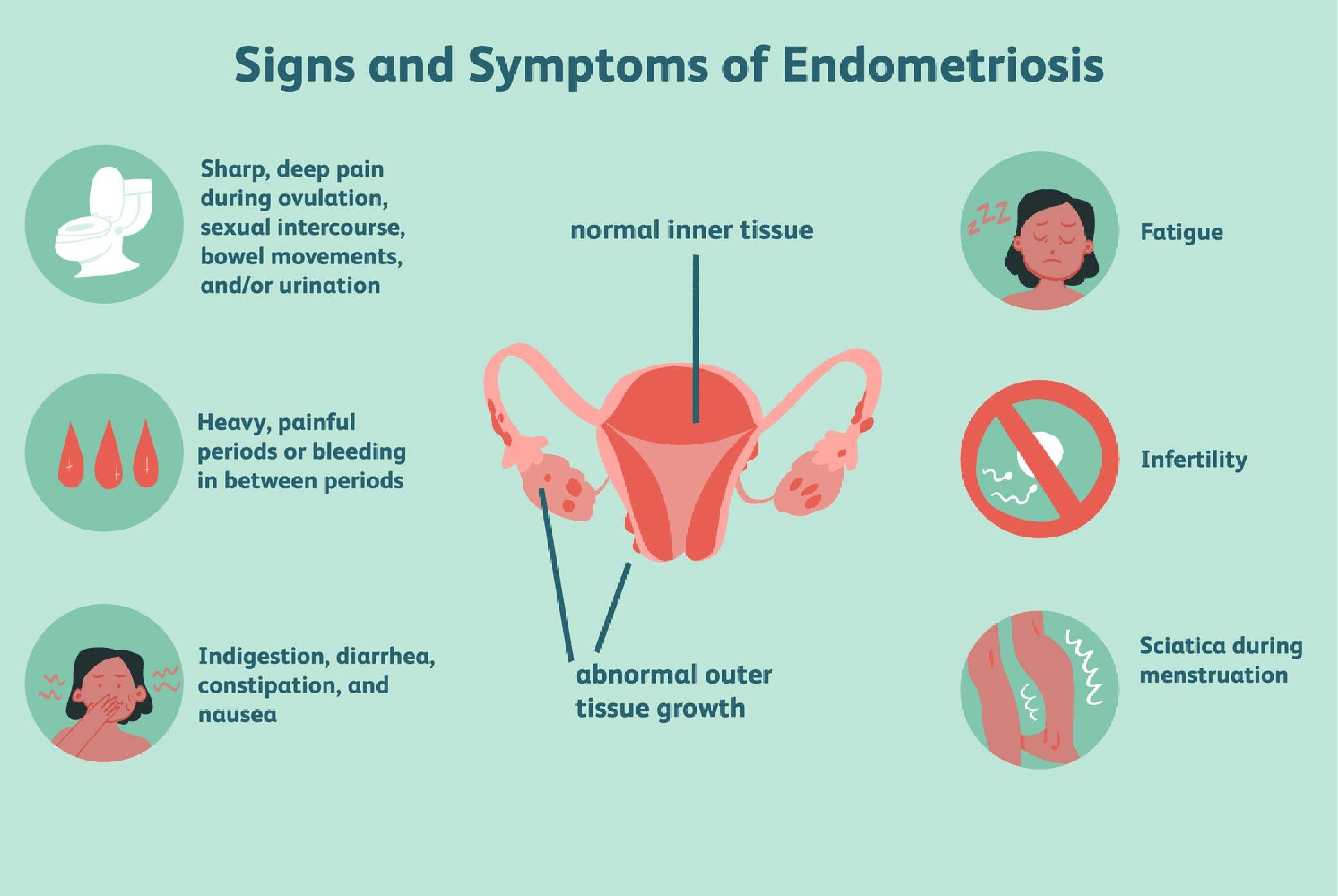 Symptoms of Endometriosis