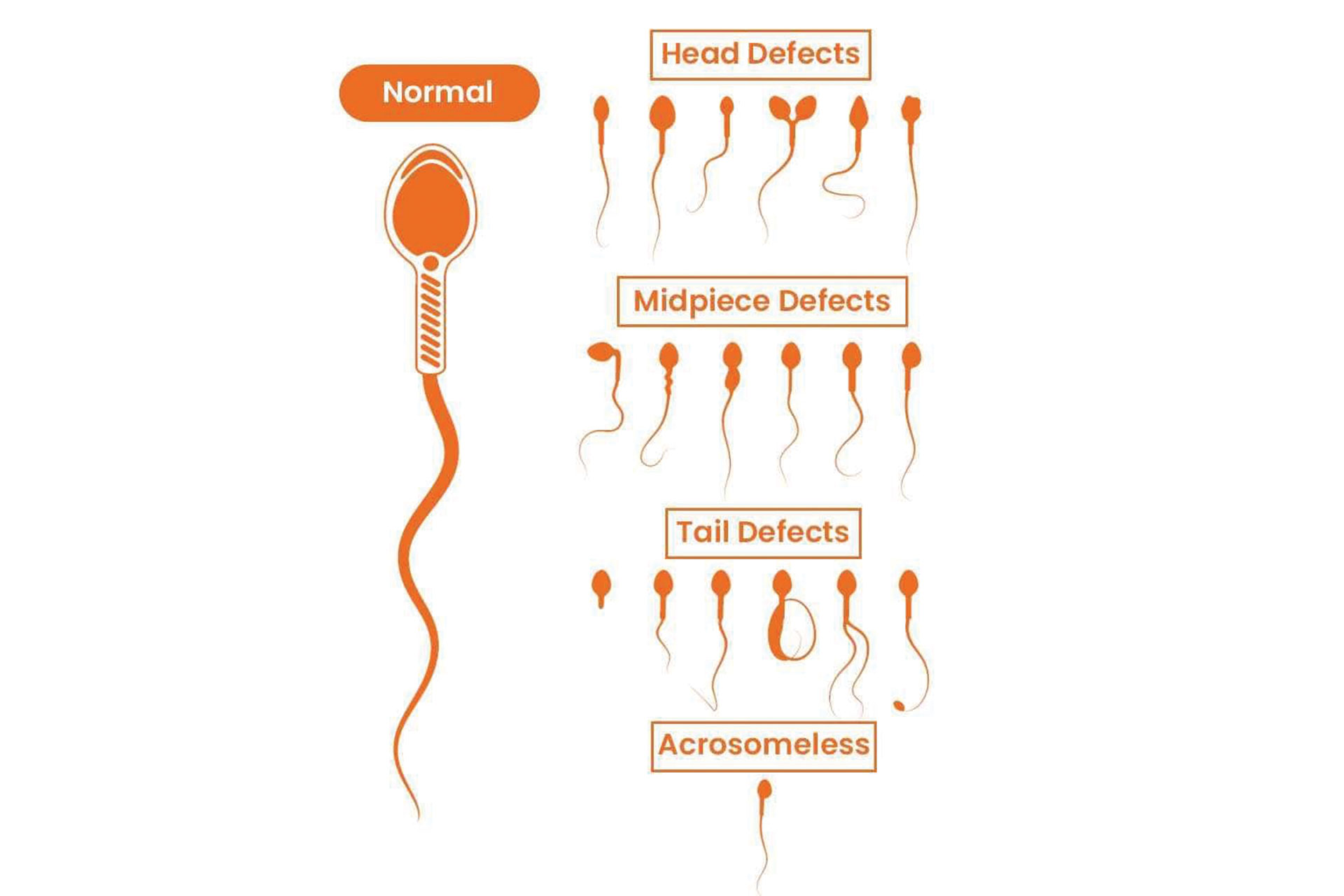 best IVF Treatment In Udaipur India
