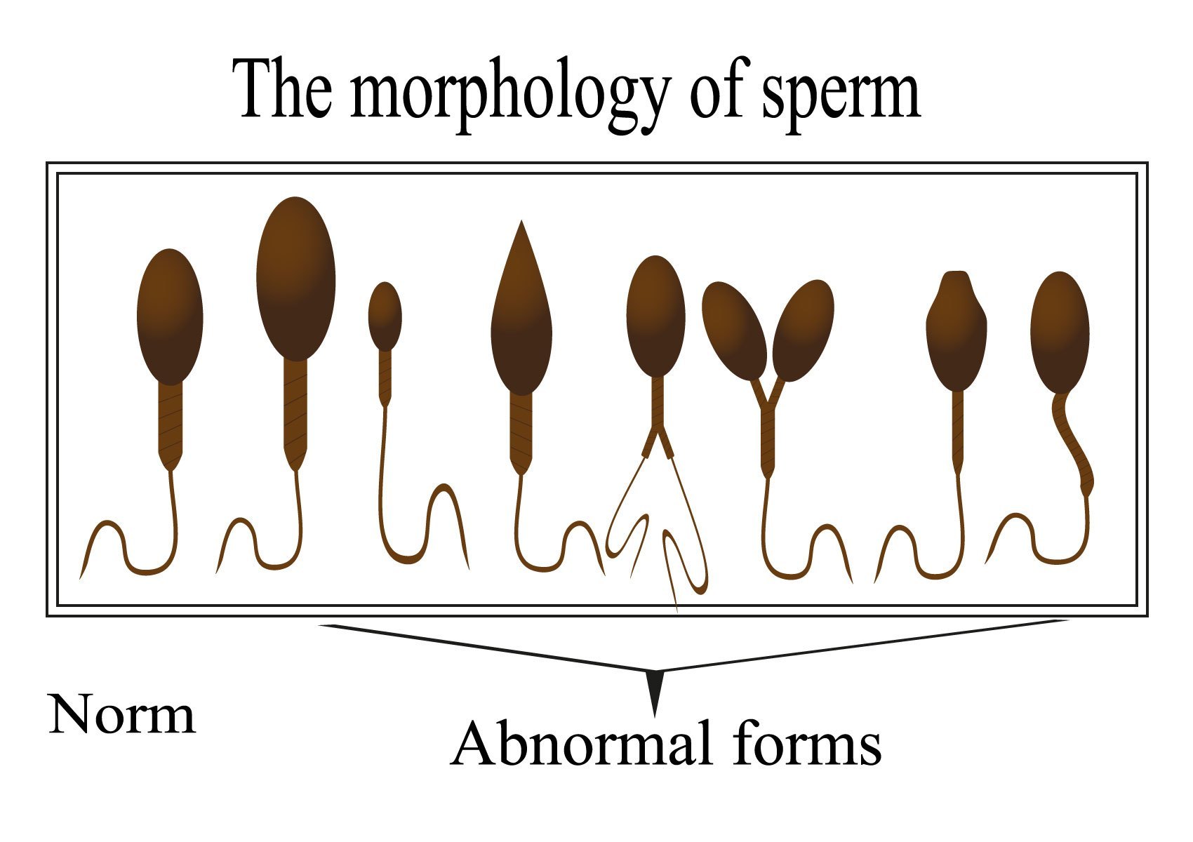 IVF Treatment In Udaipur