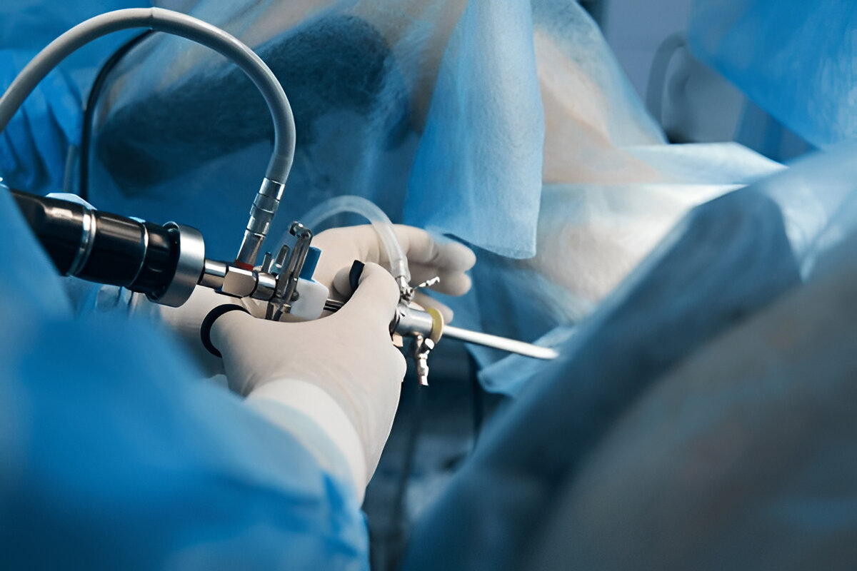 laparoscopic surgery cost