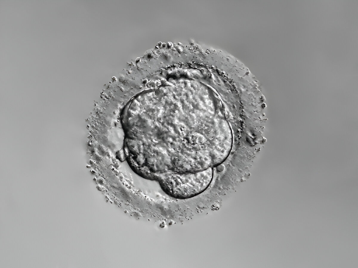 Best fertility Treatment in Udaipur