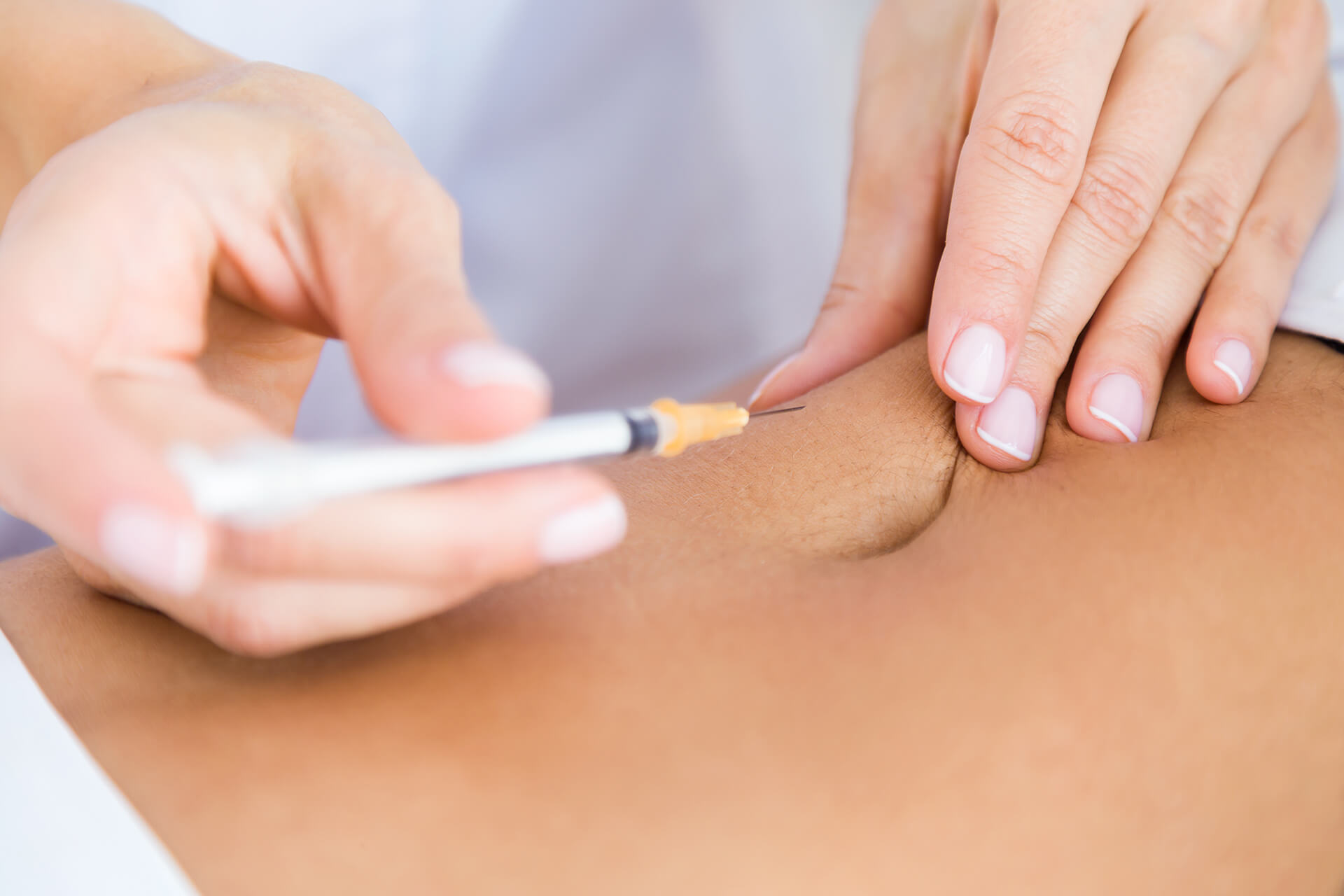 PRP Treatment